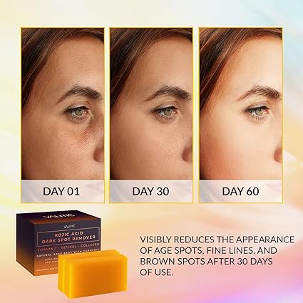 VALITIC Kojic Acid Soap Bars Dark spot remover with Vitamin C, Retinol, Collagen, Turmeric, Hyaluronic Acid, Vitamin E, Shea Butter, and Olive Oil (2 Pack).