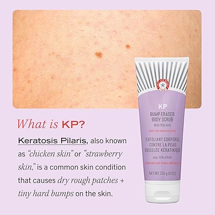 First Aid Beauty KP Bump Eraser Body Scrub, Exfoliant for Keratosis Pilaris with 10% AHA, 2 oz.