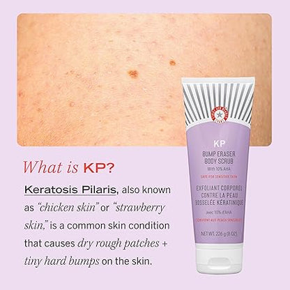 First Aid Beauty KP Bump Eraser Body Scrub, Exfoliant for Keratosis Pilaris with 10% AHA, 2 oz.